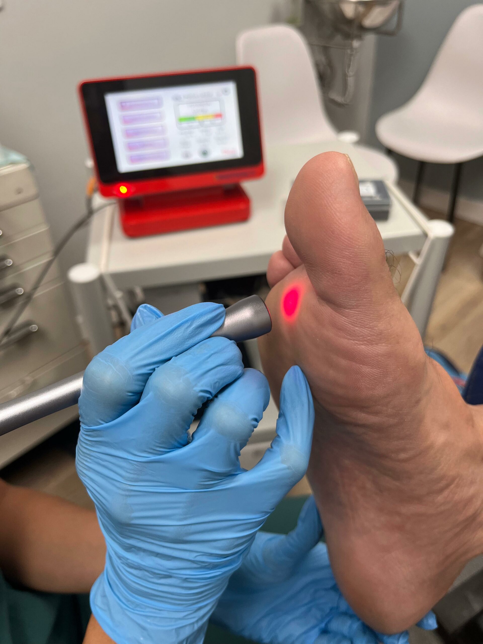 Laser podologia Laser podologia